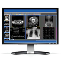 Sante PACS Server 4.0.9 - Full Version